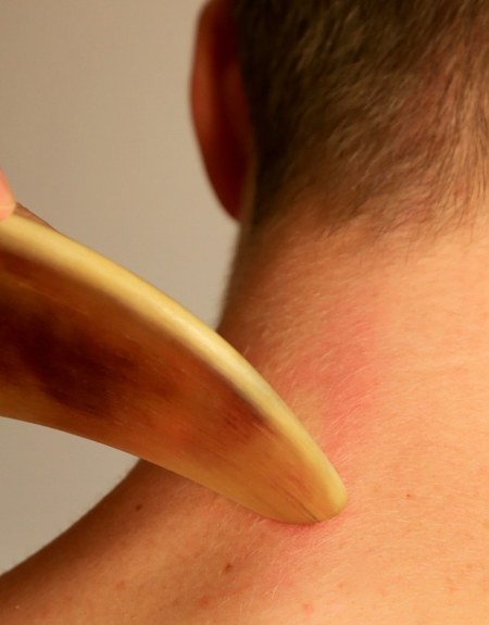 Behandlung in der Naturheilpraxis Wang