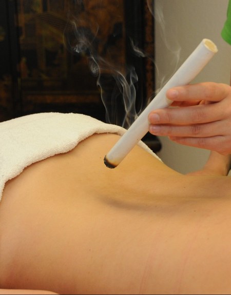 Moxibustion in der Naturheilpraxis Wang